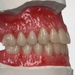 دستیار دندانپزشک زیبایی