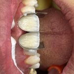 دستیار دندانپزشک زیبایی