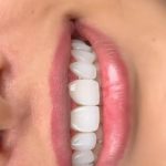 دستیار دندانپزشک زیبایی